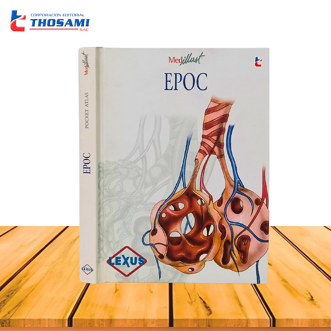 Epoc