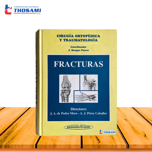 Cirugía ortopédica y traumatología: Fracturas