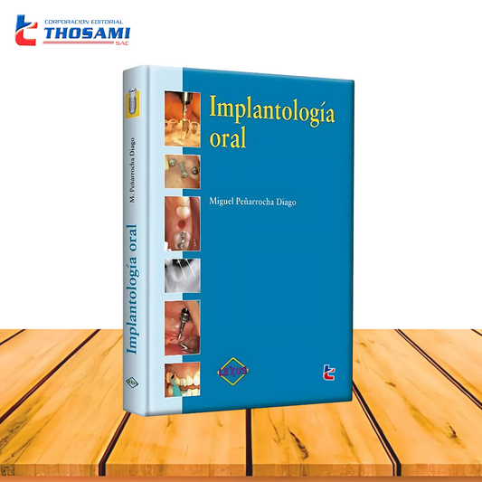 Implantología Oral