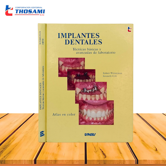 Implantes Dentales- Técnicas Básicas y Avanzadas de Laboratorio